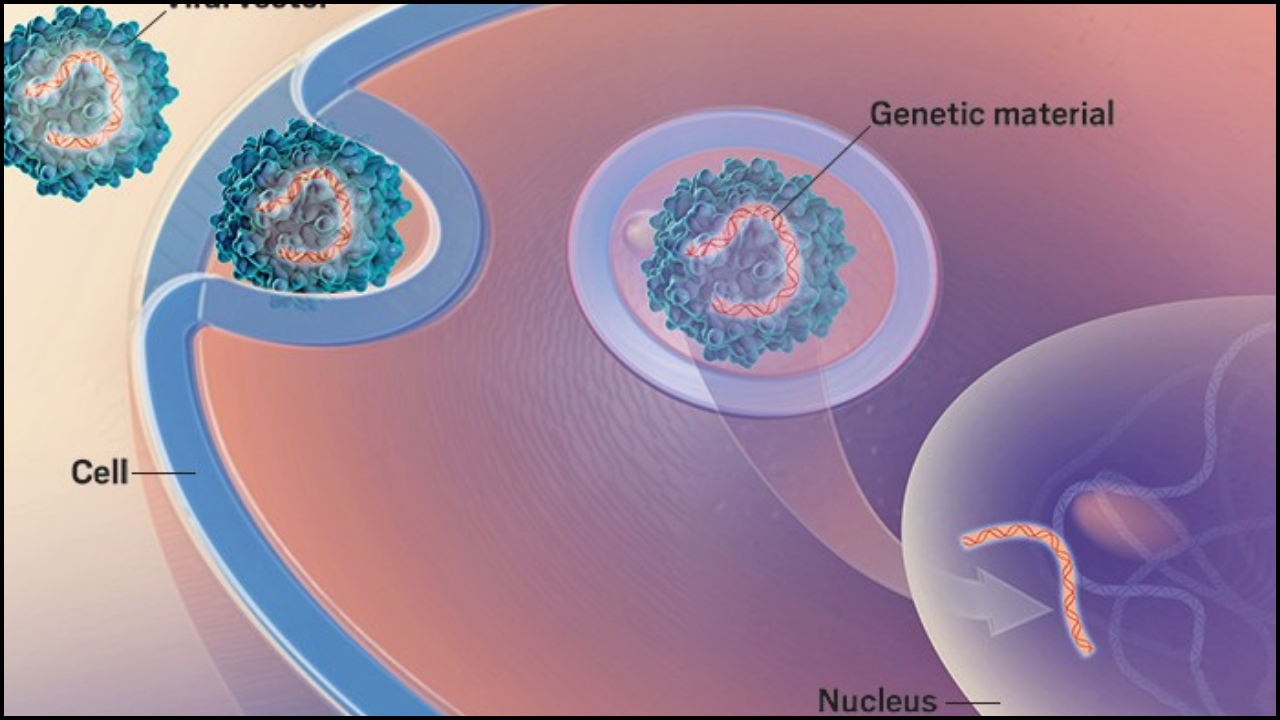 Gene Therapy’s First Successful Story: A Landmark in Clinical Medicine